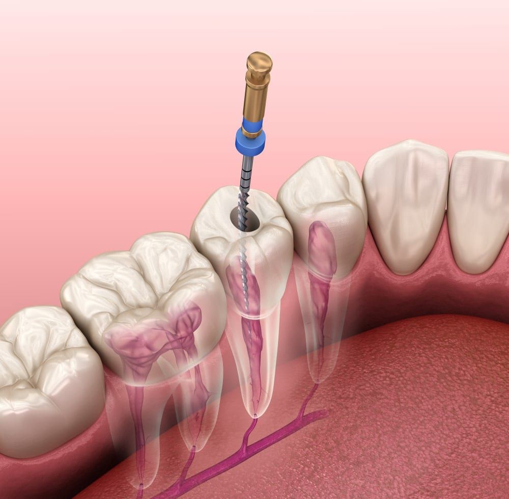 HIRA MULTI SPECIALITY DENTAL CLINIC ALANALLUR