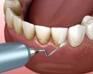 HIRA MULTI SPECIALITY DENTAL CLINIC ALANALLUR
